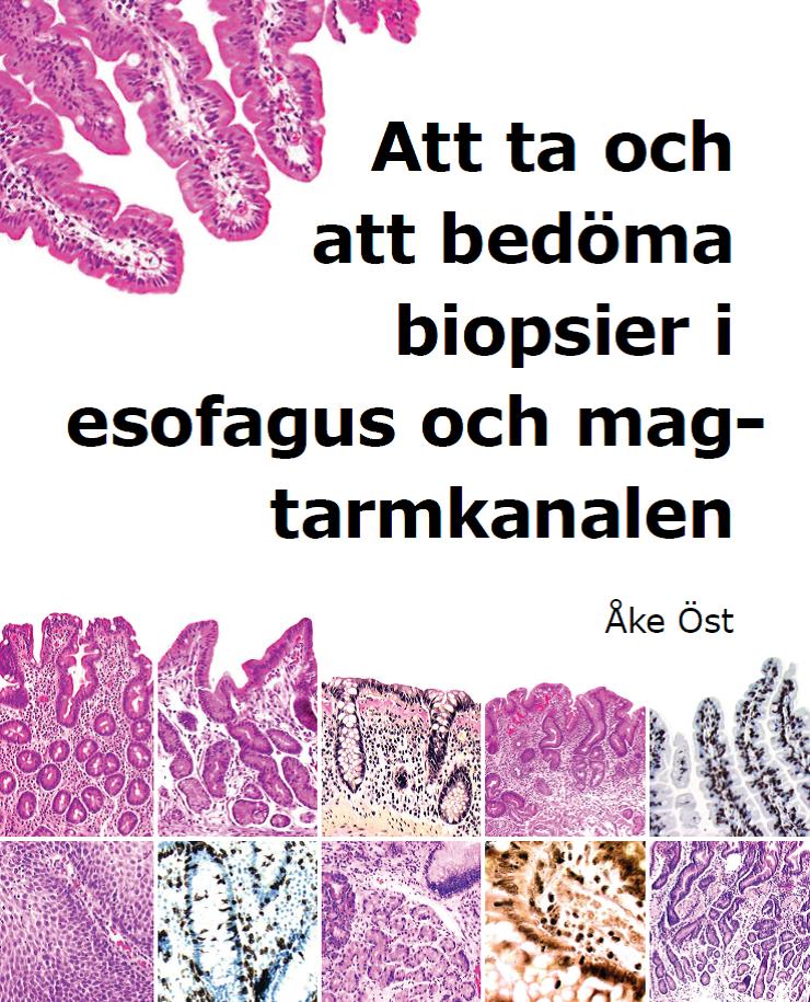 Att ta och bedöma biopsier i esofagus och mag-tarmkanalen, av Åke Öst